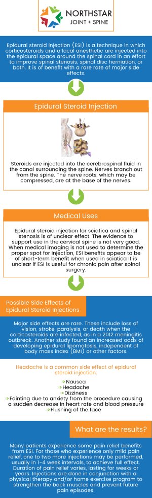 Why does a pain doctor recommend an epidural steroid injection? If you have intense, difficult-to-treat pain in your legs or arms from inflamed spinal nerves, then an epidural steroid injection might give you quick relief. Epidural steroid injections often referred to as ESIs, are a common treatment option for various types of pain, including low back pain, leg pain, neck pain, and arm pain. Dr. Robert Nocerini offers epidural steroid injections at Northstar Joint and Spine for the treatment of chronic pain. Contact us today for more information or schedule an appointment online. We are conveniently located at 7704 San Jacinto Pl Suite #200 Plano, TX 75024.