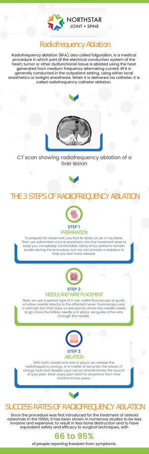 Radiofrequency Ablation (RFA) is a minimally invasive procedure used to treat chronic pain by disrupting nerve signals. This treatment targets specific nerves to provide long-lasting relief from conditions such as back and joint pain. Symptoms that may indicate the need for RFA treatment include persistent pain, limited mobility, and discomfort that does not improve with other therapies. Board Certified Dr. Robert J. Nocerini, MD, at Northstar Joint and Spine offers RFA treatment to help patients achieve significant pain relief and improve quality of life. For more information, contact us today or schedule an appointment. We are conveniently located at 7704 San Jacinto Pl Suite #200 Plano, TX 75024. Radiofrequency Ablation (RFA) is a minimally invasive procedure used to treat chronic pain by disrupting nerve signals. This treatment targets specific nerves to provide long-lasting relief from conditions such as back and joint pain. Symptoms that may indicate the need for RFA treatment include persistent pain, limited mobility, and discomfort that does not improve with other therapies. Board Certified Dr. Robert J. Nocerini, MD, at Northstar Joint and Spine offers RFA treatment to help patients achieve significant pain relief and improve quality of life. For more information, contact us today or schedule an appointment. We are conveniently located at 7704 San Jacinto Pl Suite #200 Plano, TX 75024.